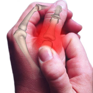 Helpful arthritis remedies