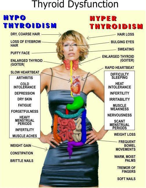 Thyroid - Issues and Solutions